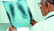 A health care practitioner examines a chest x-ray for diagnosing pneumonia.