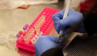 FILE PHOTO: Researchers at the Microbiology Research Facility work with coronavirus samples as a trial begins to see whether malaria treatment hydroxychloroquine can prevent or reduce the severity of the coronavirus disease (COVID-19), at the University o