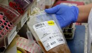 A medical worker at Magen David Adom’s Blood Services holds a plasma sample donated by recovered novel coronavirus patients on June 1, 2020. / AFP / GIL COHEN-MAGEN
