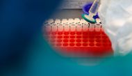 A scientist filters out samples during the research and development of a vaccine against the coronavirus disease (COVID-19) at a laboratory of BIOCAD biotechnology company in Saint Petersburg, Russia June 11, 2020. REUTERS/Anton Vaganov
