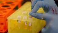 FILE PHOTO: A Lab technician works at Sorrento Therapeutics where efforts are underway to develop an antibody, STI-1499, to help in prevention of the coronavirus disease (COVID-19) in San Diego, California, U.S., May 22, 2020. REUTERS/Mike Blake/File Phot
