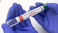 File Photo: Test tube labelled 