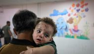 A man holds one of the injured children of Palestinian cameraman Mohammed Alaloul following an Israeli strike on the Al-Maghazi refugee camp in Deir Balah in the central Gaza Strip, at the al-Quds hospital in the same city on November 5, 2023. Photo by MAHMUD HAMS / AFP