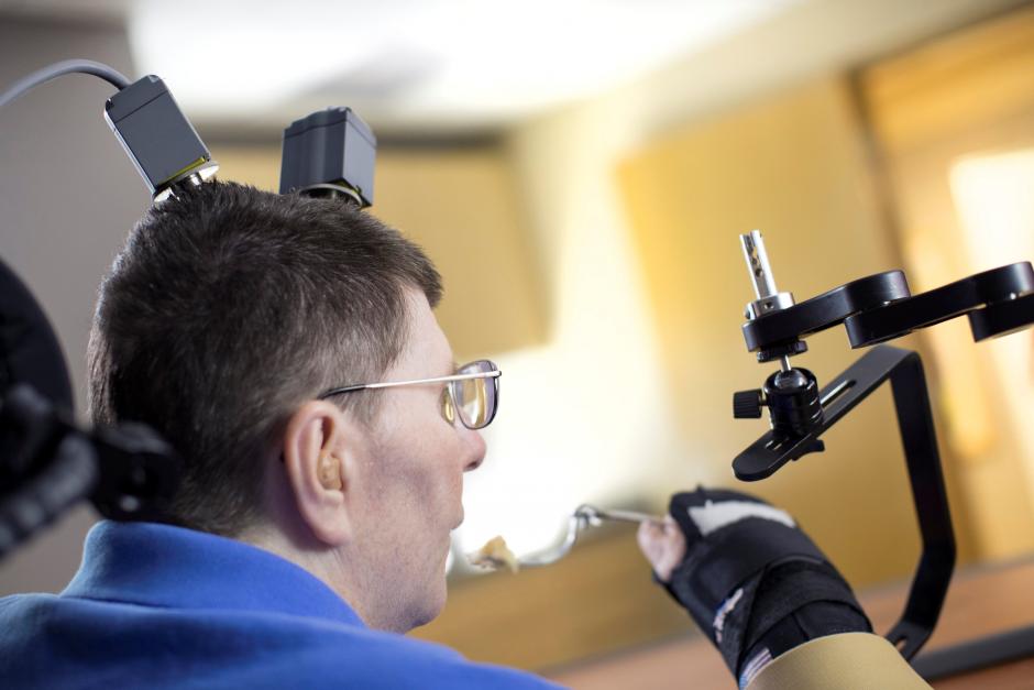 REPRESENTATIVE IMAGE: Bill Kochevar, 56, is using computer-brain interface technology and an electrical stimulation system to move his own arm after eight years of paralysis, in this undated photo. Case Western Reserve University/Cleveland FES Center/Hand