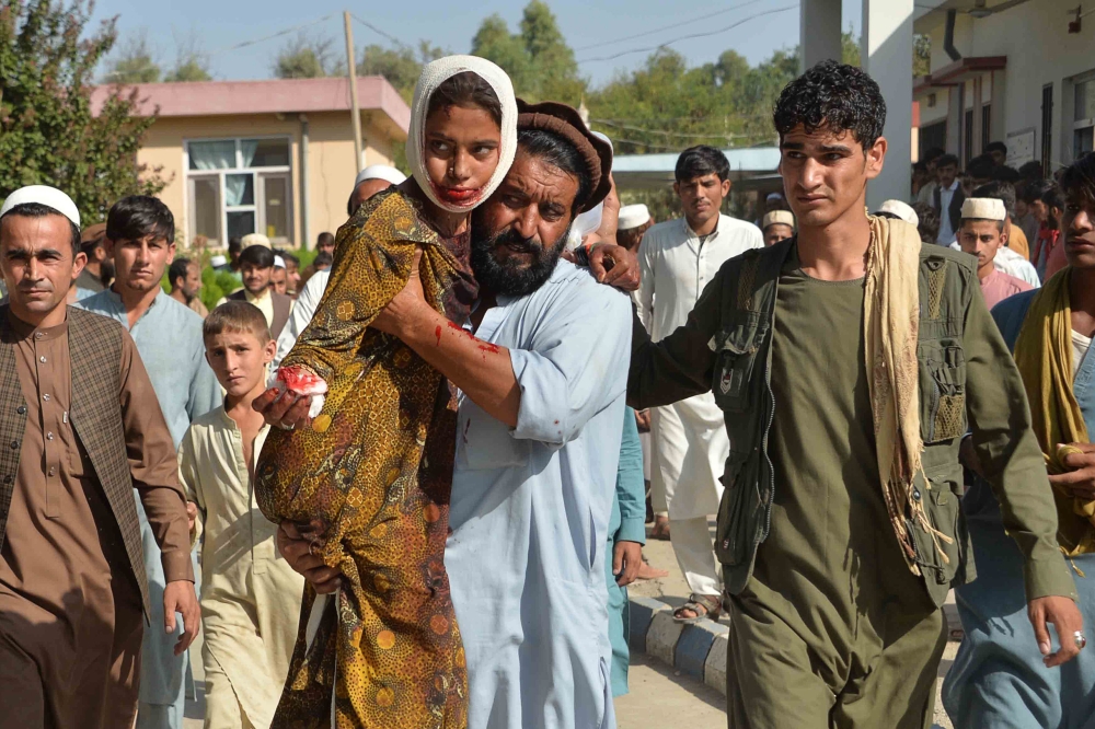 An injured youth (C-L) is carried to a hospital following a car bomb attack that targeted a government building, in the Ghani Khel district of Nangarhar province, about 35 km from Jalalabad on October 3, 2020.  AFP / NOORULLAH SHIRZADA
