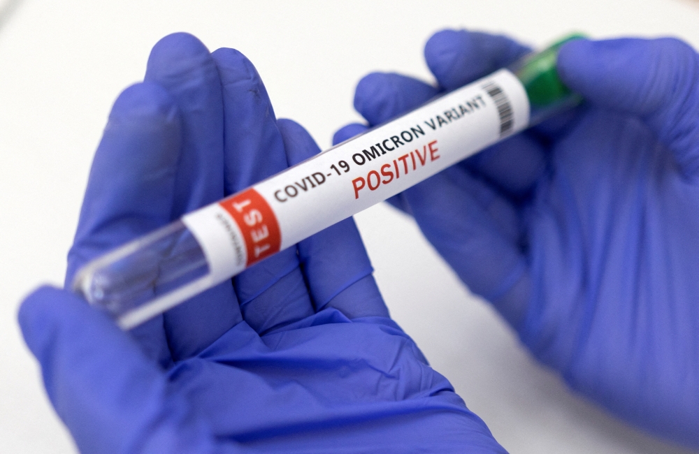 File Photo: Test tube labelled 