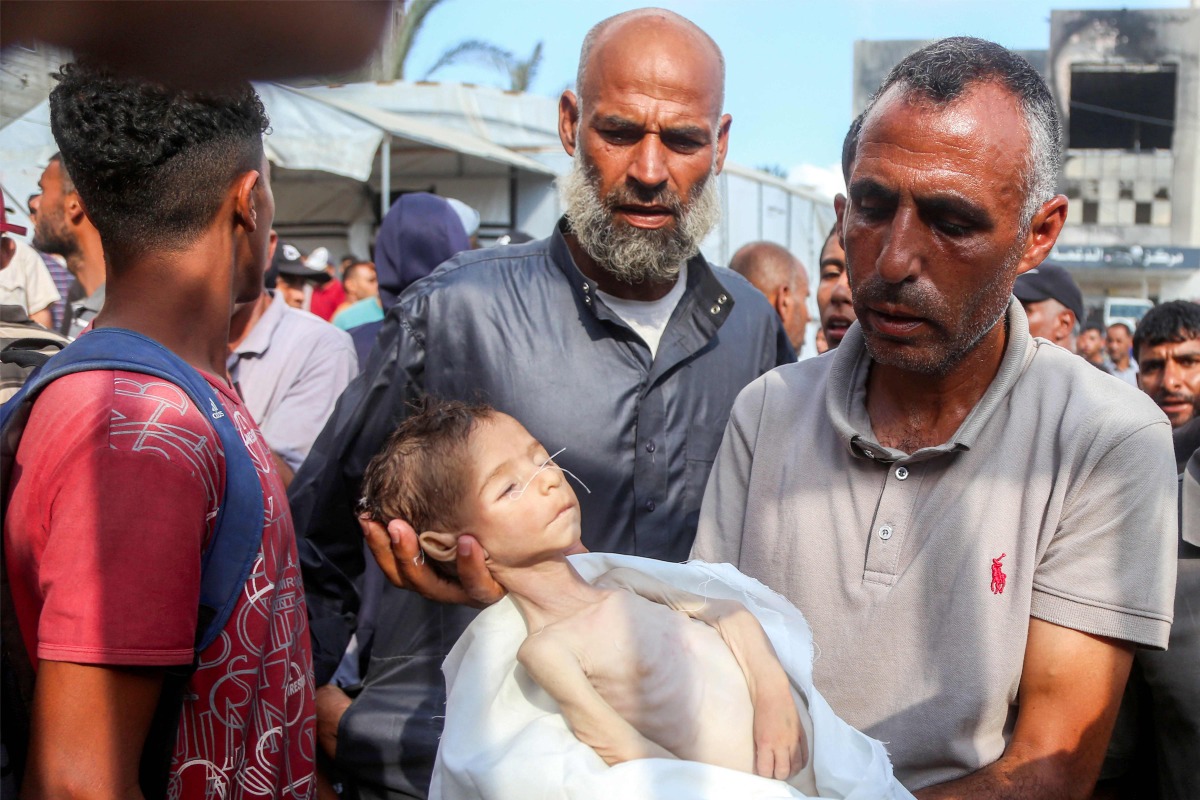 The father of Yahya Fadi al-Najjar, an infant who died due to malnourishment, holds his body during the funeral at Nasser Medical Complex in Khan Yunis in the southern Gaza Strip on July 20, 2025. (Photo by AFP)
