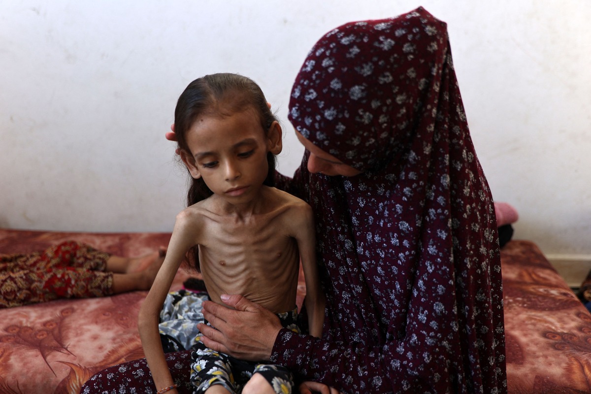 Nine-year-old malnourished Palestinian girl Mariam Dawwas sits on the floor with her mother in the Rimal neighbourhood in Gaza City on August 2, 2025. (Photo by Omar AL-QATTAA / AFP)
