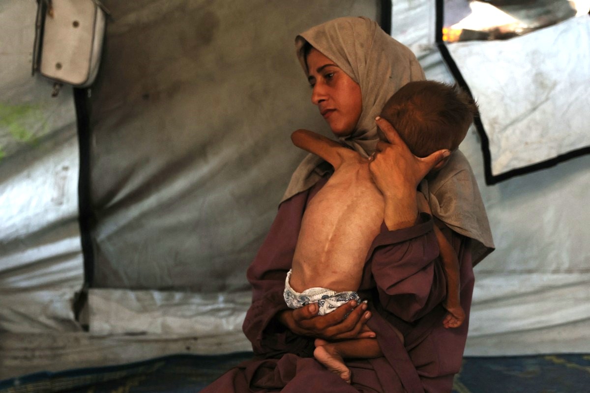 Hidaya, a 31-year-old Palestinian mother, carries her 18-month-old sick son who is also displaying signs of malnutrition, inside their tent at the Al-Shati refugee camp, west of Gaza City, on July 24, 2025. (Photo by Omar Al-Qattaa / AFP)

