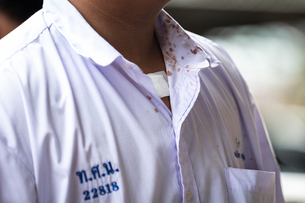 Blood stains are seen on a student's shirt collar following a school shooting in Bang Kruai district, Nonthaburi province, north of Thailand's capital Bangkok, on August 7, 2026. Photo by CHANAKARN LAOSARAKHAM / AFP