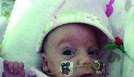 Four-month-old Baby Masa ready for discahrge from Women's Hospital.