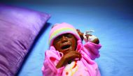 A malnourished boy lies on a bed at a malnutrition intensive care unit in the Red Sea port city of Houdeidah, Yemen. 