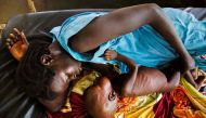 This file photo taken on October 11, 2016 shows a mother breastfeeding her child who suffers acute malnutrition at the clinic run by Doctors Without Borders (MSF) in Aweil, northern Bahr al-Ghazal, South Sudan. South Sudan's government said on February 20
