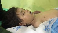 An unconscious Syrian child receives treatment at a hospital in Khan Sheikhun, a rebel-held town in the northwestern Syrian Idlib province, following a suspected toxic gas attack on April 4, 2017. AFP / Omar haj kadour