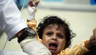 A Yemeni child, suspected of being infected with cholera, receives treatment at a hospital in Sanaa on May 15, 2017. AFP / Mohammed Huwais