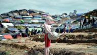 An albino Rohingya refugee poses for a picture in Cox's Bazar, Bangladesh, September 27, 2017. Reuters/Cathal McNaughton