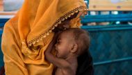In this picture taken on October 1, 2017, a Rohingya Muslim refugee holds her child as she waits to see a doctor at a medical centre at Balukhali refugee camp near the town of Gumdhum in Cox's Bazar. AFP / FRED DUFOUR 