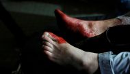 FILE PHOTO: The feet of an injured man are seen covered in blood after a suicide attack in Kabul, Afghanistan, January 10, 2017 (Reuters / Mohammad Ismail) 