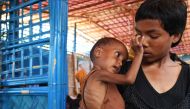 Zahid Hasan, the 1.5 years old Rohingya Muslim refugee with her sister waits to see a doctor to receive treatment for severe malnutrition at the Balukhali refugee camp in Bangladesh's Ukhia district on November 6, 2017. AFP / Dibyangshu Sarkar
