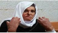 Israa Jaabis, sentenced to 11 years, suffers from burns all over her body and is not being treated adequately inside an Israeli prison [Wadi Hilweh Information Center]