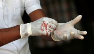 Blood on gloves of a police mortuary official is seen as he waits for casualties after an explosion at St. Anthony's Shrine, Kochchikade church in Colombo, Sri Lanka April 21, 2019. Reuters/Dinuka Liyanawatte