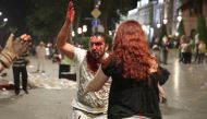 A man with blood on his face reacts after he was injured during a rally against a Russian lawmaker's visit in Tbilisi, Georgia June 21, 2019. Reuters/Irakli Gedenidze