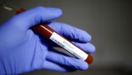 FILE PHOTO: Test tube with coronavirus name label is seen in this illustration taken on January 29, 2020. REUTERS/Dado Ruvic/File Photo