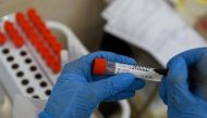 A medical person wearing protective equipment marks a swab sample at a medical facility in Moscow on July 16, 2020, on the first day the Russian capital started providing free testing for the coronavirus disease to its residents. / AFP / Kirill KUDRYAVTSE