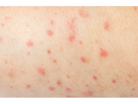 Representational image / Freepik