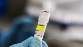 nstitute holding a container used to diagnose the Andes hantavirus, which contains RNA from the Andes virus as part of the detection process, in Buenos Aires on May 6, 2026. Argentina has seen an increase in hantavirus cases but not an outbreak, an expert told AFP on May 6, as infections aboard a cruise ship have provoked a global health scare. The MV Hondius set sail from Ushuaia in southern Argentina on April 1 and is currently anchored off the coast of Cape Verde after three passengers died, possibly of hantavirus. (Photo by Handout / ARGENTINE HEALTH MINISTRY / AFP) 