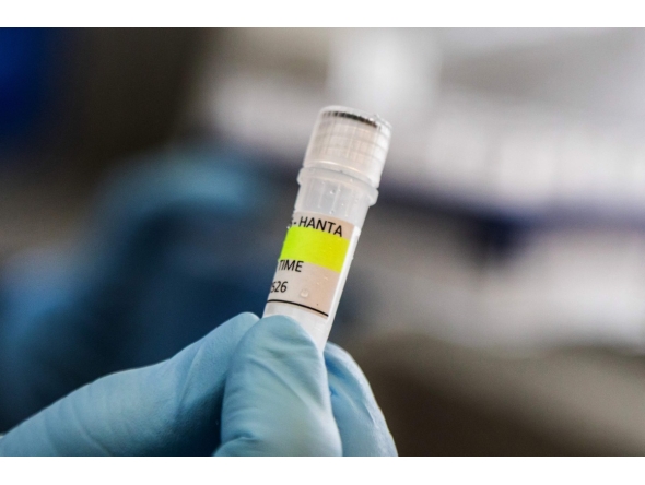 nstitute holding a container used to diagnose the Andes hantavirus, which contains RNA from the Andes virus as part of the detection process, in Buenos Aires on May 6, 2026. Argentina has seen an increase in hantavirus cases but not an outbreak, an expert told AFP on May 6, as infections aboard a cruise ship have provoked a global health scare. The MV Hondius set sail from Ushuaia in southern Argentina on April 1 and is currently anchored off the coast of Cape Verde after three passengers died, possibly of hantavirus. (Photo by Handout / ARGENTINE HEALTH MINISTRY / AFP) 