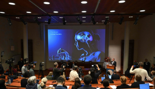 Karolinska Institute neuroscience professor Abdel El Manira speaks in front of a screen displaying an illustration of the human brain during the announcement of the winners of the 2026 Nobel Prize in Physiology or Medicine at the Karolinska Institute in Stockholm, Sweden, on October 5, 2026. (Photo by Jonathan Nackstrand / AFP)