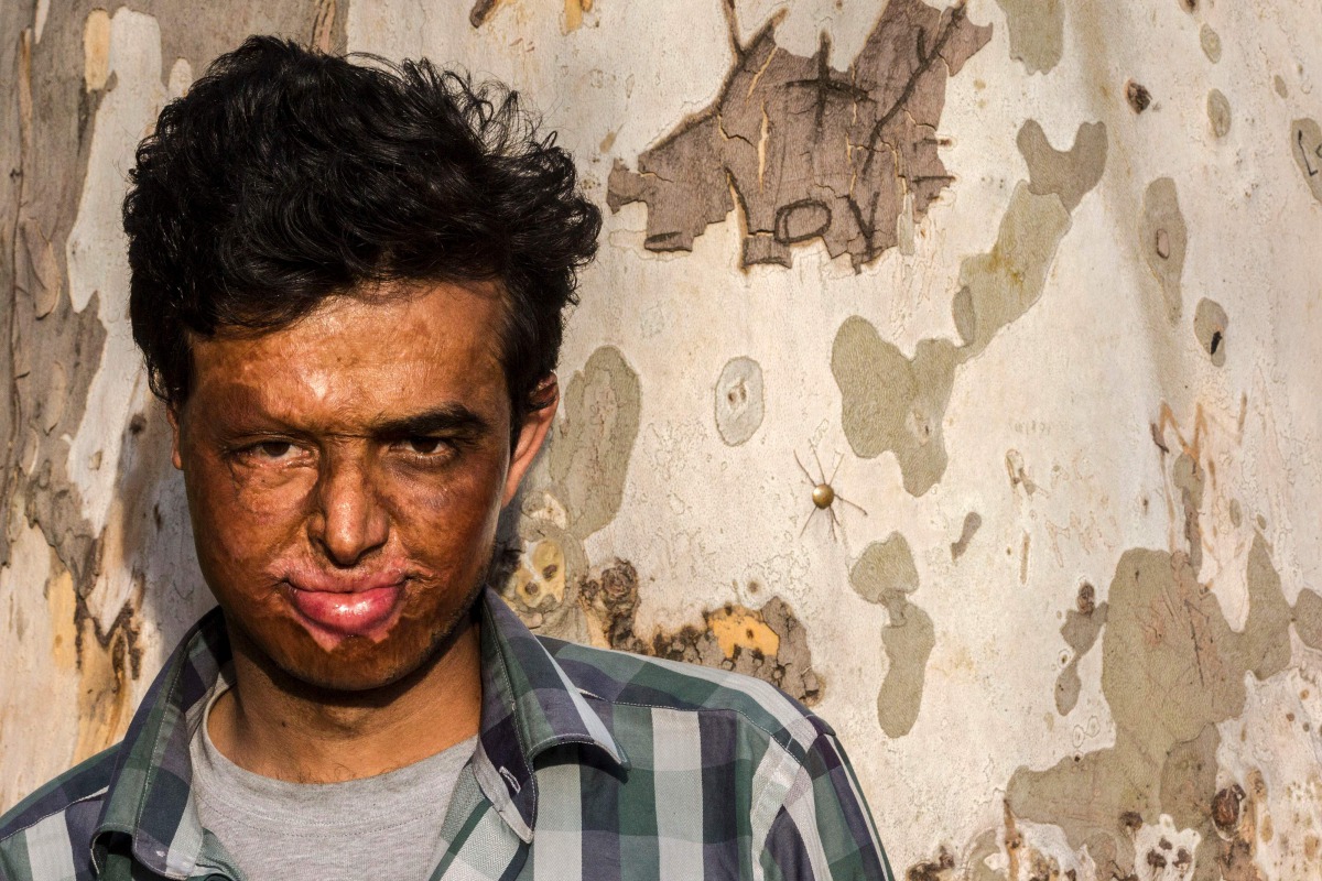 Attal Shafihullah, a 16-years old migrant from Afghanistan, poses for a photograph in a park near the central bus station in Belgrade on March 24, 2017. AFP / Oliver Bunic