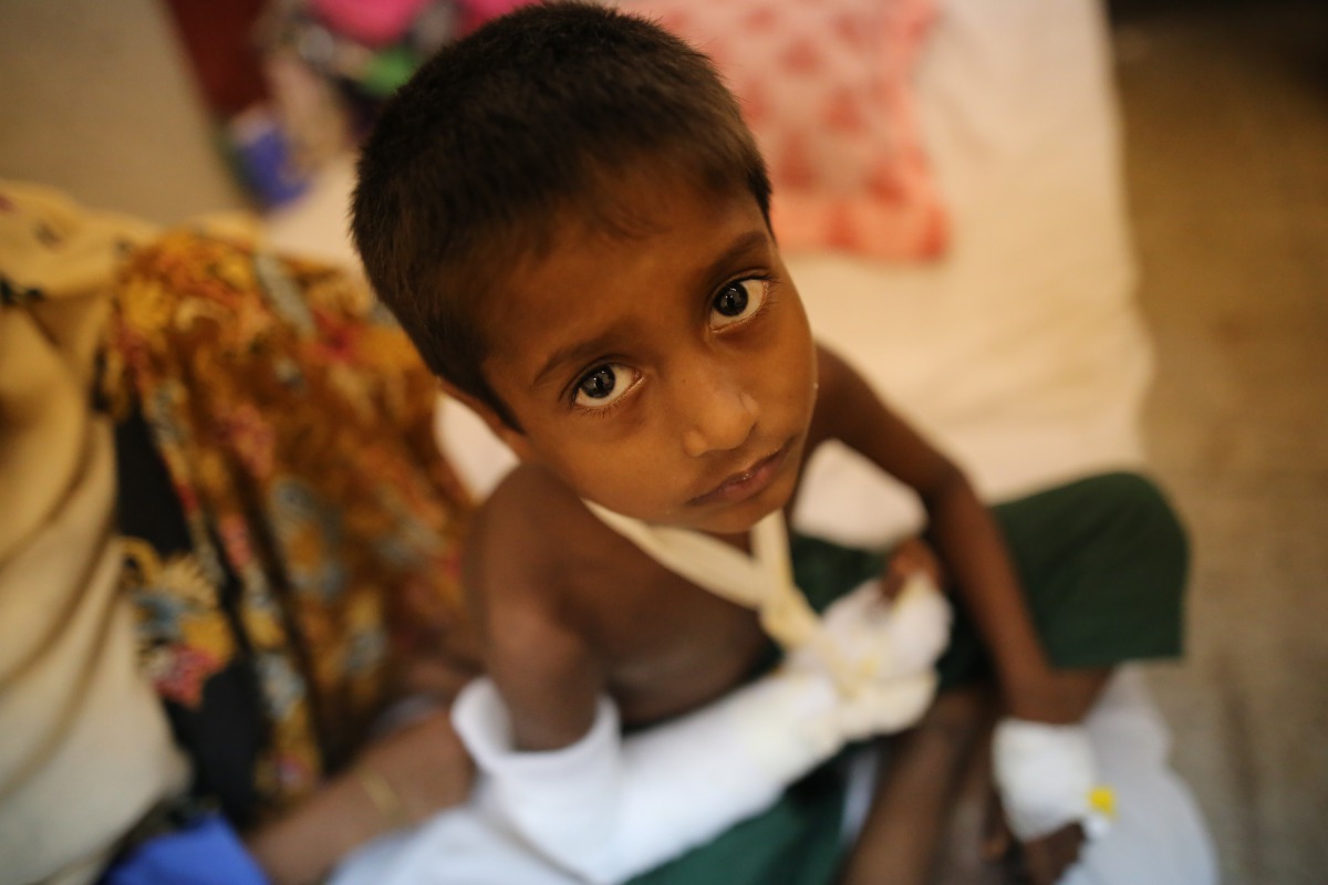 A wounded Rohingya Muslim child, fled from ongoing military operations in Myanmar’s Rakhine state, sits on a stretcher at Cox's Bazar Government General Hospital in Cox's Bazar, Bangladesh on September 13, 2017. (Zakir Hossain Chowdhury/Anadolu Agency)
