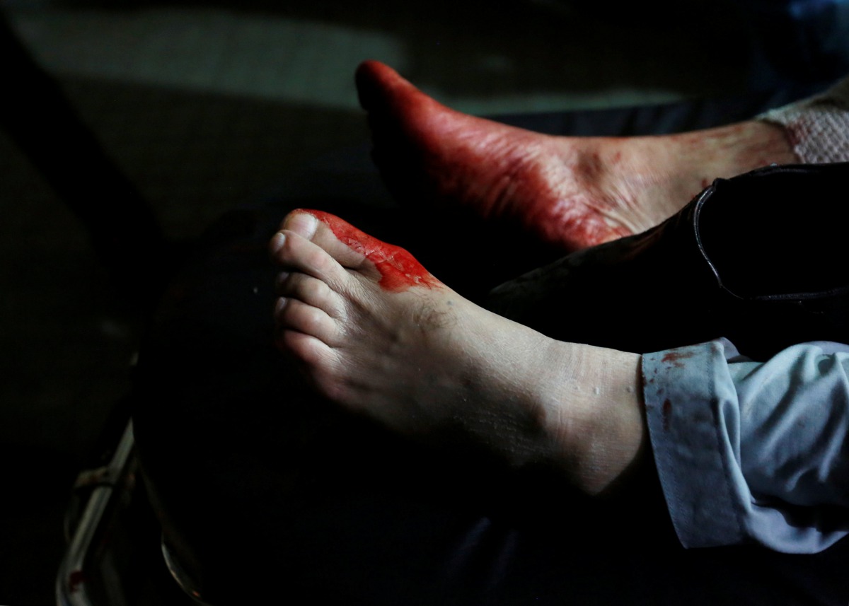 FILE PHOTO: The feet of an injured man are seen covered in blood after a suicide attack in Kabul, Afghanistan, January 10, 2017 (Reuters / Mohammad Ismail) 