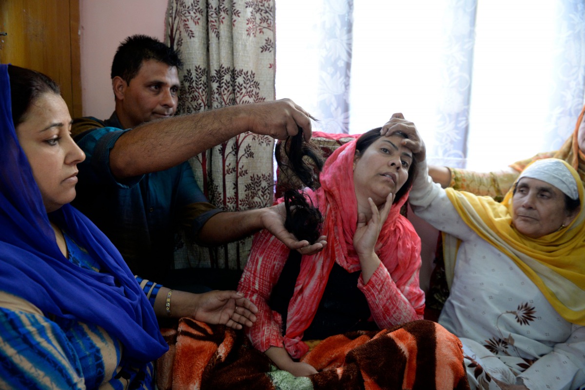 In this photograph taken on October 13, 2017, Kashmiri resident Tasleema (C), and the victim of a 'braid chopping', reacts as a man displays her hair, which was chopped off in an attack, in the Batamaloo area of Srinagar. AFP / Tauseef Mustafa