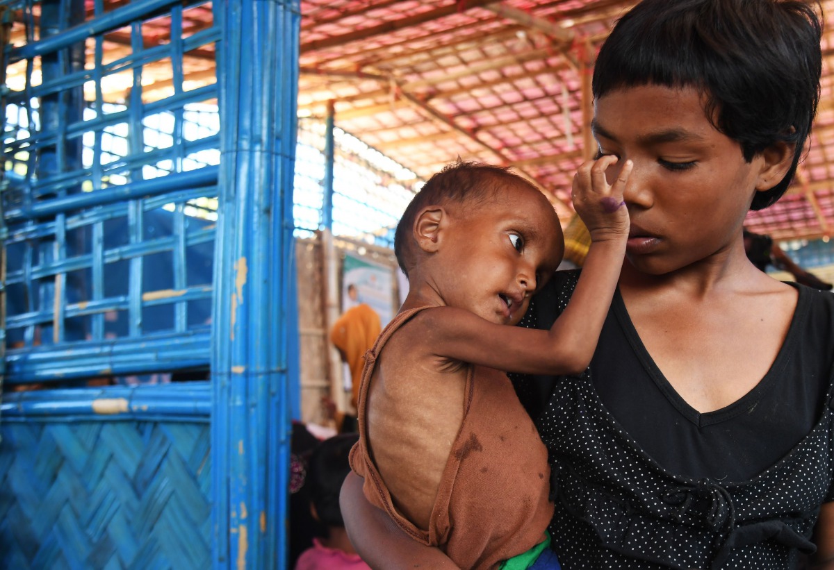 Zahid Hasan, the 1.5 years old Rohingya Muslim refugee with her sister waits to see a doctor to receive treatment for severe malnutrition at the Balukhali refugee camp in Bangladesh's Ukhia district on November 6, 2017. AFP / Dibyangshu Sarkar