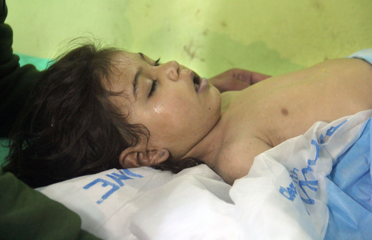 An unconscious Syrian child receives treatment at a hospital in Khan Sheikhun, in the northwestern Syrian Idlib province following a suspected toxic gas attack on April 4, 2017 (AFP Omar haj) 