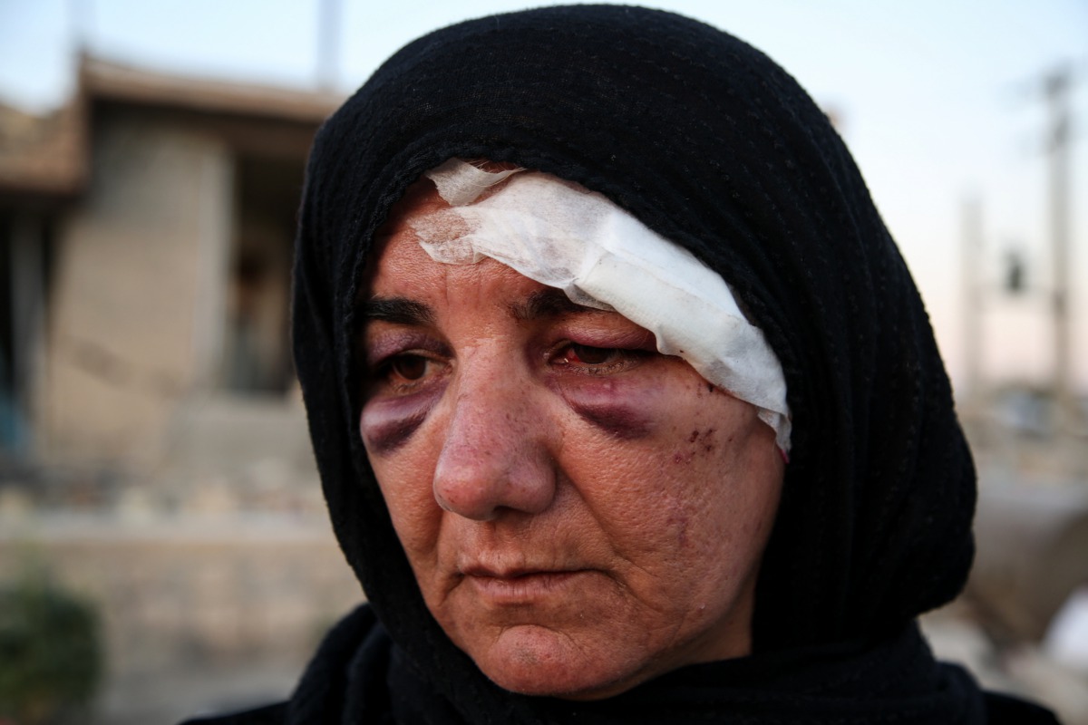 A wounded woman is seen at debris of a building in Kalaleh town of Kermanshah, Iran on November 14, 2017 following a 7.3 magnitude earthquake that hit the Iraq and Iran. (Fatemeh Bahrami - Anadolu Agency)