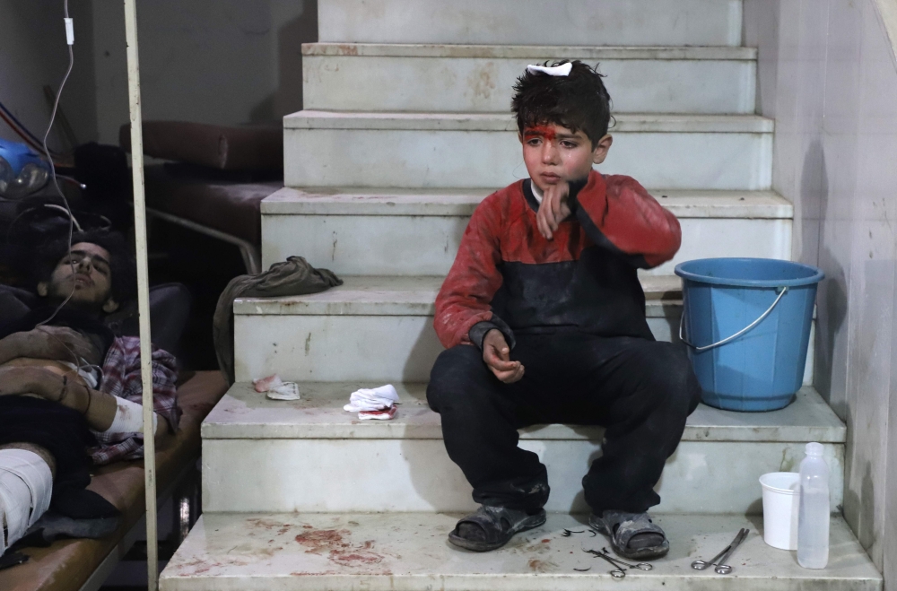 :A wounded Syrian boy waits to receive treatment at a make-shift hospital in Kafr Batna in the besieged Eastern Ghouta region on the outskirts of the capital Damascus following Syrian government bombardments on February 21, 2018.  AFP / Amer Almohibany