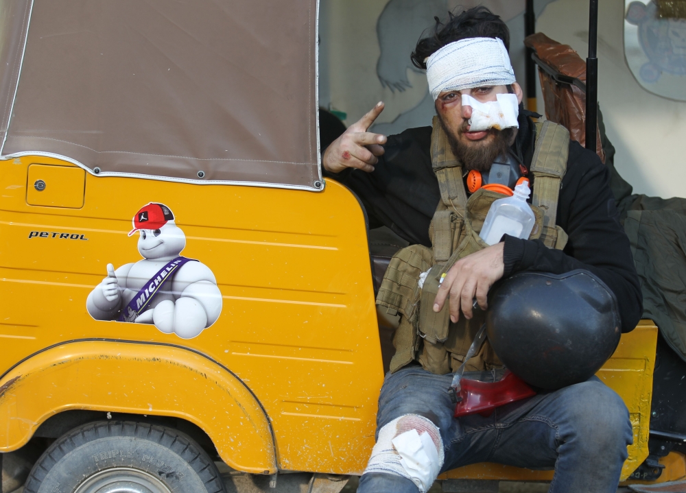 An injured Iraqi protester gestures the 
