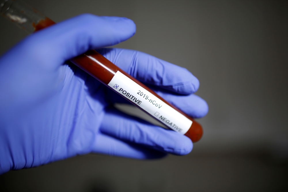FILE PHOTO: Test tube with coronavirus name label is seen in this illustration taken on January 29, 2020. REUTERS/Dado Ruvic/File Photo