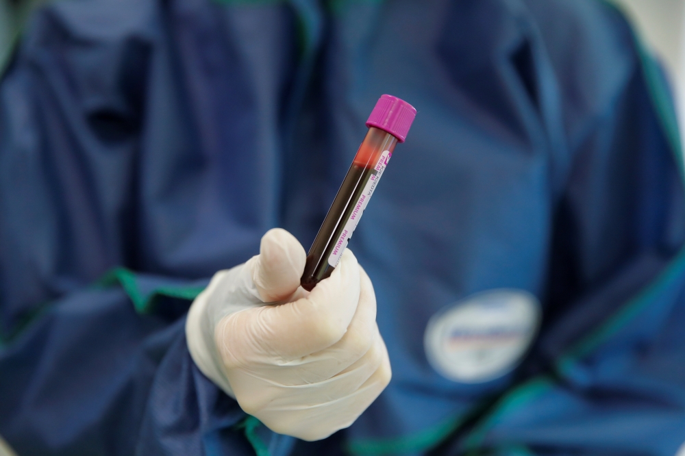 A medical specialist holds a testing tube with blood in Hadassah clinic, which offers tests for for antibodies against the coronavirus disease (COVID-19), at the Skolkovo innovation centre on the outskirts of Moscow, Russia April 24, 2020. REUTERS/Maxim S