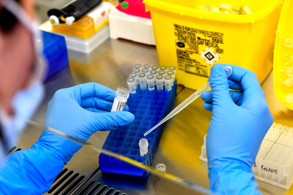 A lab assistant manipulates samples, at a COVID-19 screening centre of Saint Andre Hospital in Bordeaux, on May 20, 2020. AFP / GEORGES GOBET
