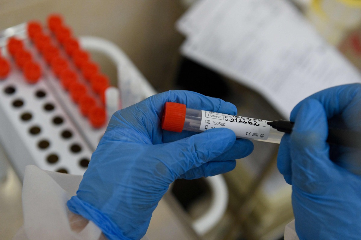 A medical person wearing protective equipment marks a swab sample at a medical facility in Moscow on July 16, 2020, on the first day the Russian capital started providing free testing for the coronavirus disease to its residents. / AFP / Kirill KUDRYAVTSE