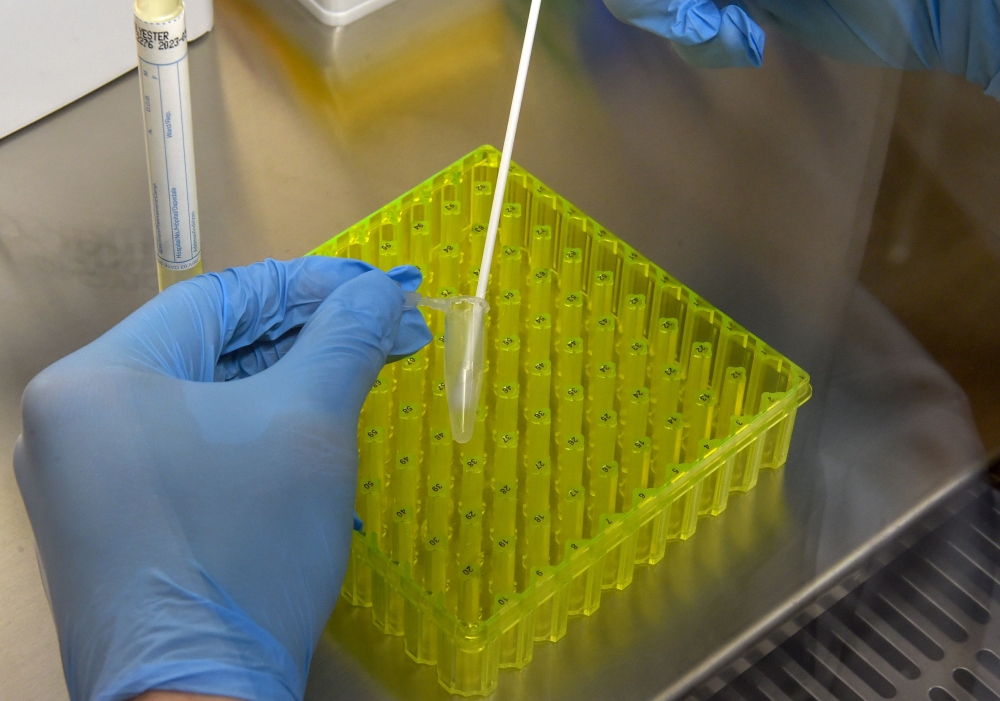 In this file photo taken on July 10, 2020, A lab assistant preparating for testing corona samples from passengers at the corona screening station in the medical center of the Franz-Josef-Strauss airport in Munich, southern Germany, amid the novel coronavi