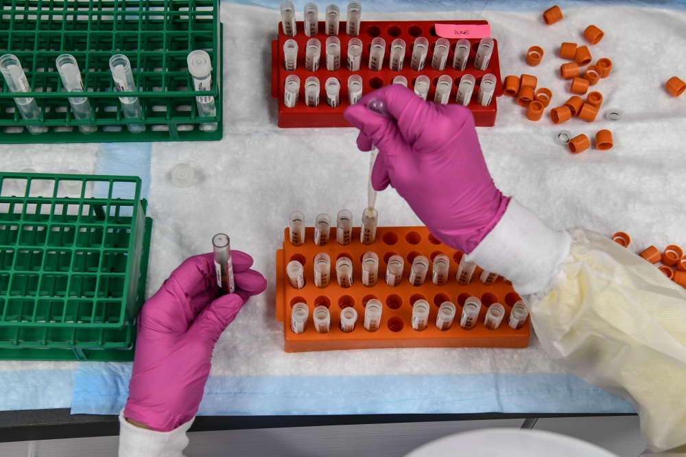 In this file photo a lab technician sorts blood samples for COVID-19 vaccination study at the Research Centers of America in Hollywood, Florida  (AFP / CHANDAN KHANNA)