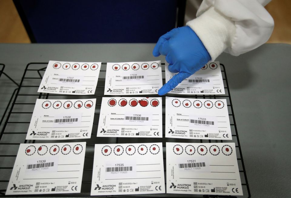 Blood samples are pictured during a clinical trial of tests for the coronavirus disease (COVID-19) antibodies, at Keele University, in Keele, Britain June 30, 2020. REUTERS/Carl Recine

Blood samples are pictured during a clinical trial of tests for the