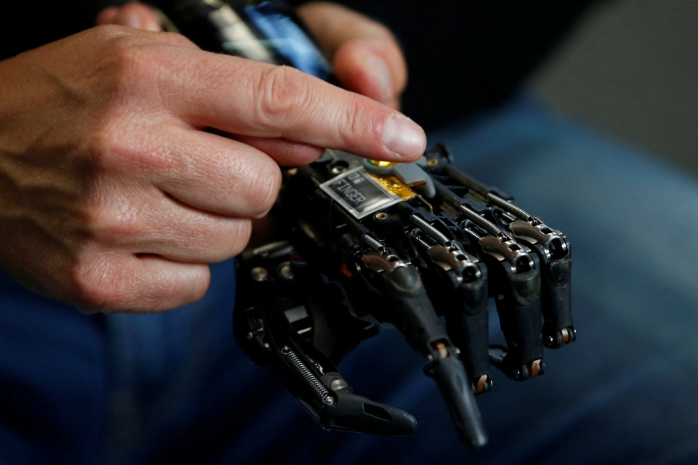 COVVI Group CEO Simon Pollard holds the bionic hand developed by COVVI, at Quayside Business Park, in Leeds, Britain August 11, 2022. REUTERS/Craig Brough