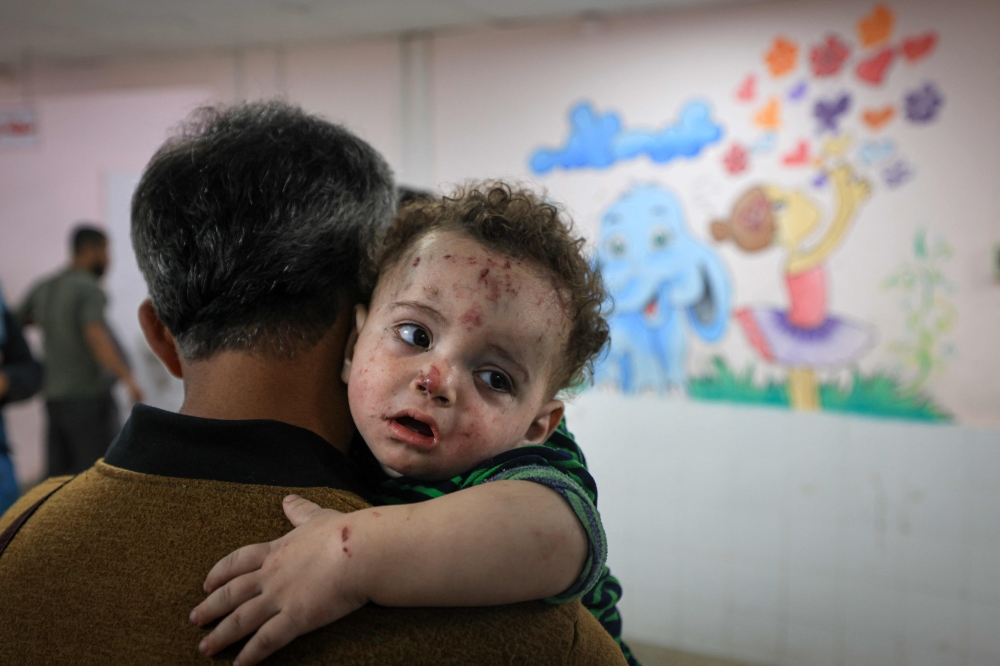 A man holds one of the injured children of Palestinian cameraman Mohammed Alaloul following an Israeli strike on the Al-Maghazi refugee camp in Deir Balah in the central Gaza Strip, at the al-Quds hospital in the same city on November 5, 2023. Photo by MAHMUD HAMS / AFP
